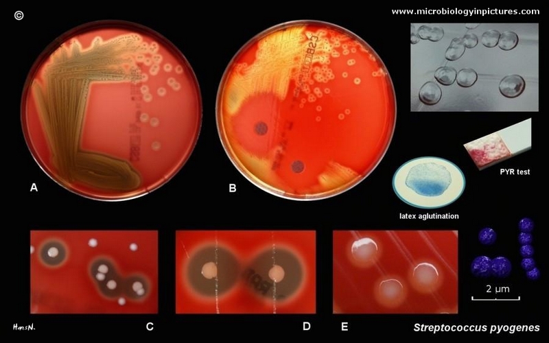 Streptococcus Pyogenes Group A Streptococcus Gas Group A Strep The